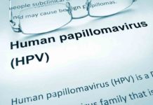 Human Papillomavirus (HPV) Causes Symptoms and Treatments