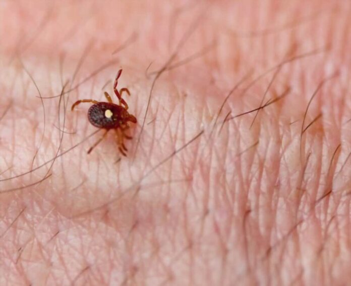 Diet for Lyme Disease