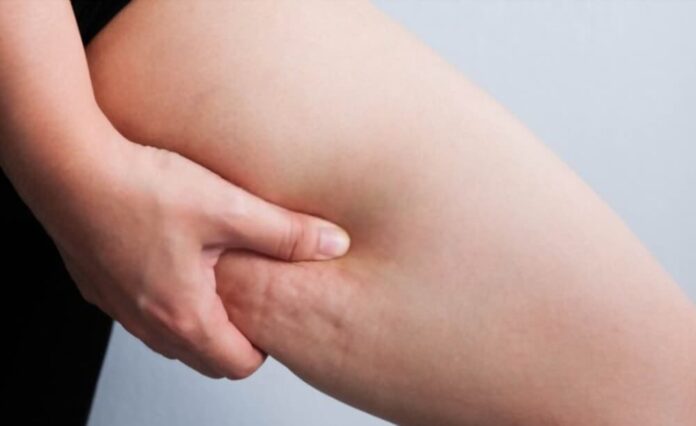 Anti-Cellulite Massage: The Secret To A Great Skin