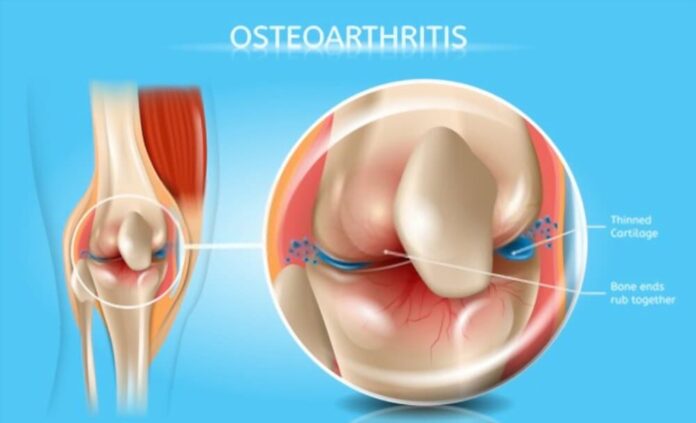 Diet for Osteopenia