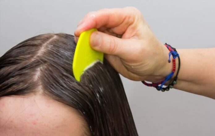 Natural Remedies For Lice