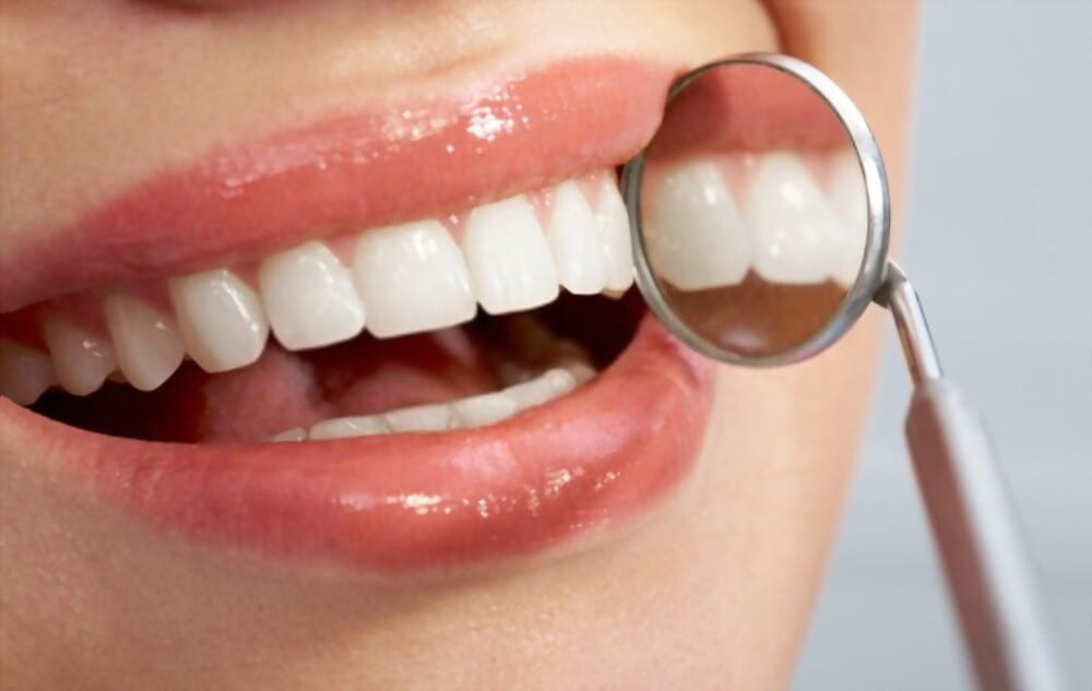 Teeth Whitening Treatments: Top Natural Remedies