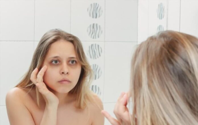 How Lack Of Sleep Can Mess With Your Face And Beauty